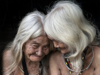 How to Make Gray Hair Thicker : Ask a Dermatologist