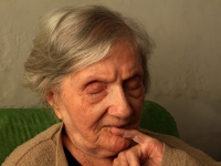 Anti Aging Treatments