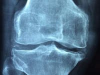 Radiología del Sistema Osteomuscular