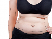 Cirurgia plástica e reparadora