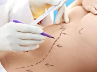 Métodos e técnicas de avaliação em estética