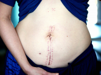 Sistemas do corpo Humano e saúde I