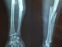 IMAGENS RADIOLOGIA II