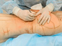 ESTÉTICA E CIRURGIA