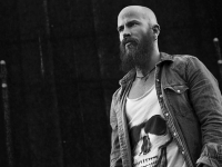 Gli Esperti di Calvizie