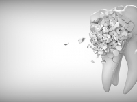 Ortopedia Funcional de los Maxilares