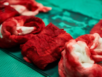 Anestesiología Pediátrica