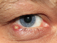 Dermatopatias Bacterianas, Virais, Fúngicas, Riquetsiais e Protozoárias-Veterinária