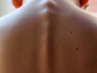 Exercício Físico Nos Distúrbios Da Coluna Vertebral