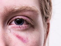 Reflexões Sobre O Trauma