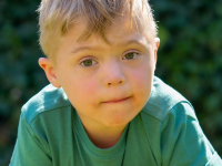 Introdução Síndrome De Down