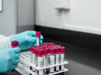 Técnicas de Triagem e de Coleta