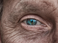 Tumores Neoplásicos e não Neoplásicos e Anormalidades Pigmentares